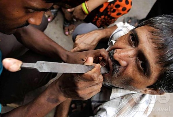 Шок! Придорожные дантисты в Индии